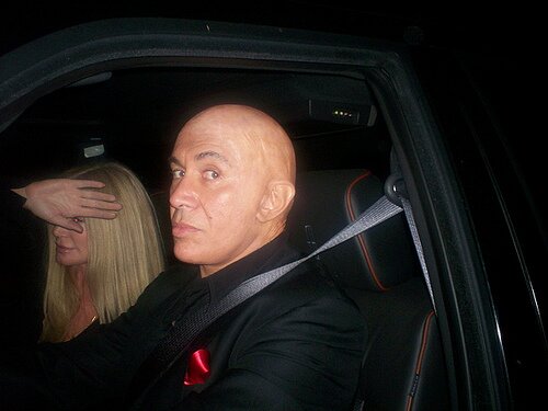 Gene Simmons is Bald