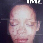 Battered, Bruise and Beaten Rihanna Domestic Violence Face Photo from TMZ