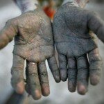 Hand of a Pre-Teen Child from Bangladesh - Worn Out with Labor